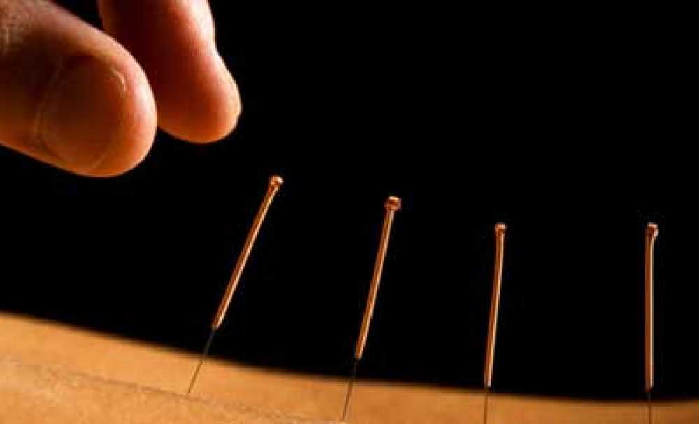 Akupunktur Antidepresan Kullanımını Azaltabilir