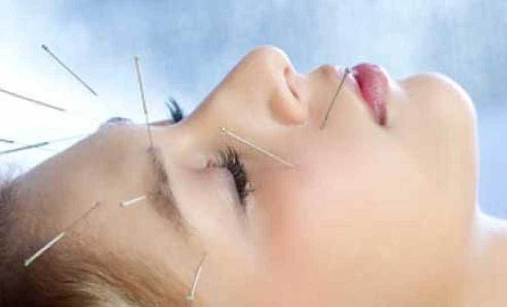 Migren Ağrılarına Akupunktur Engeli